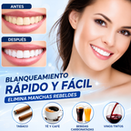 BLANQUEADOR DENTAL LED PORTÁTIL DE 5 LUCES – Sonrisa más blanca en minutos
